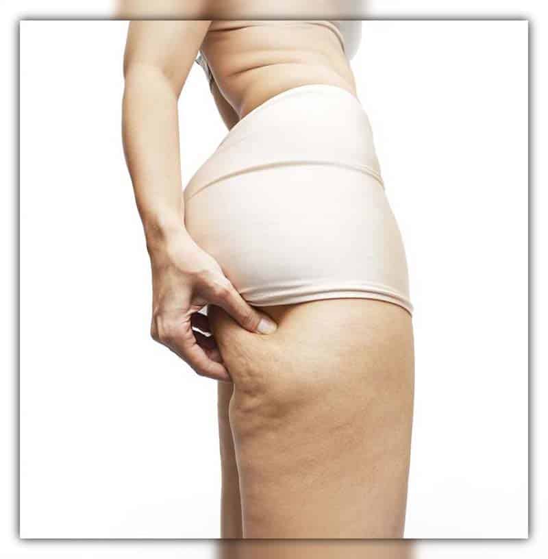 how to lose cellulite on thighs and bum